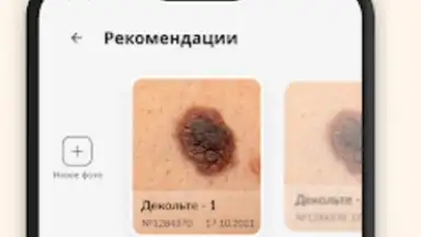 Про родинки screenshot 5