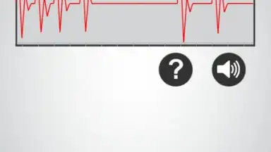Monitor Heart Rate screenshot 5