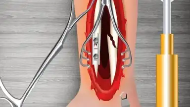 WristSurgeryDoctor screenshot 15