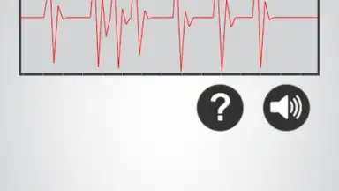 Heart Rate Monitor screenshot 4