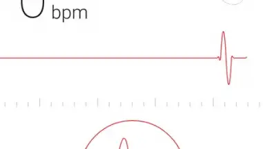 Cardiograph screenshot 5