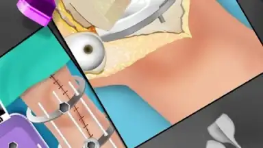 KneeSurgery screenshot 1