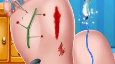 Foot Surgery Doctor Care screenshot 10