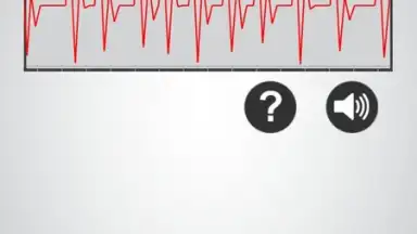 Monitor Heart Rate screenshot 4