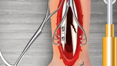 WristSurgeryDoctor screenshot 9