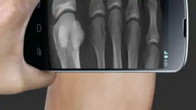 X Ray Scanner Pro screenshot 1