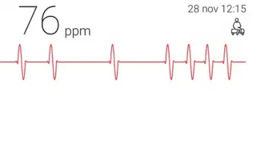 Cardiograph screenshot 2
