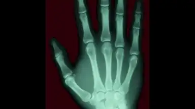 Scanner X-ray screenshot 5