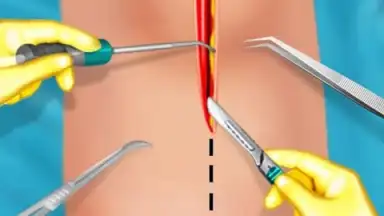 KneeSurgery screenshot 2