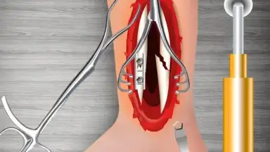 WristSurgeryDoctor screenshot 2