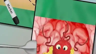 BrainSurgery screenshot 2