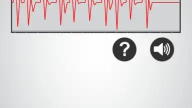 Monitor Heart Rate screenshot 3