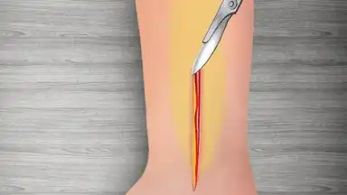 WristSurgeryDoctor screenshot 16