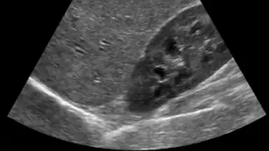Scanner X-ray screenshot 3