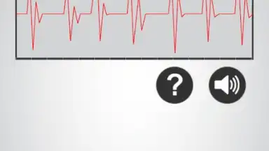 Heart Rate Monitor screenshot 2