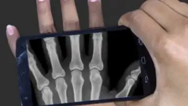 X Ray Scanner Pro screenshot 2