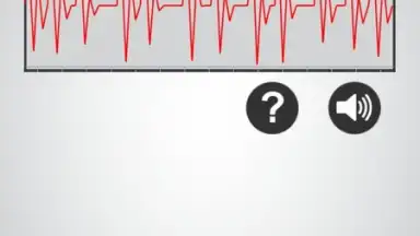 Monitor Heart Rate screenshot 1